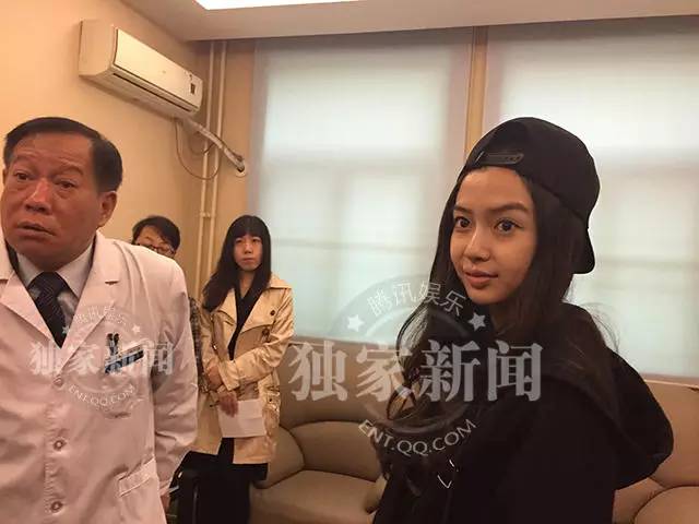 【angelababy卸妆照】angelababy素颜照