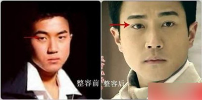 刘恺威整容前后照片对比_刘恺威未整容前照片