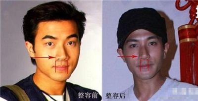 刘恺威整容前后照片对比_刘恺威未整容前照片