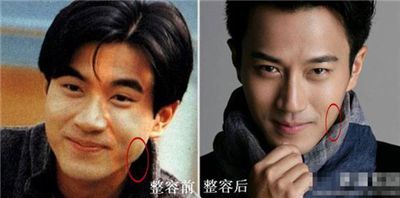 刘恺威整容前后照片对比_刘恺威未整容前照片