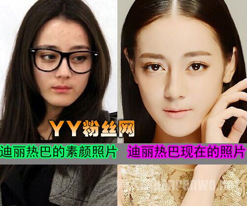 迪丽热巴整容前照片_迪丽热巴素颜照片