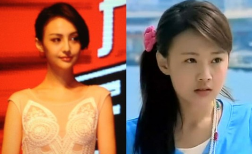 【郑爽整容前后对比照片】郑爽整容整了哪些部位