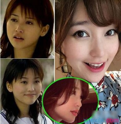 【金莎整容失败是怎么回事】金莎整容前后照片大盘点